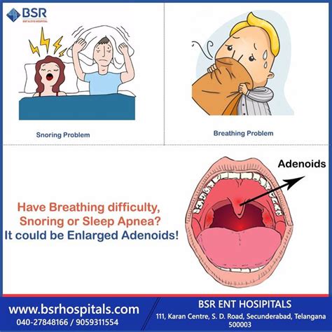 Enlarged Tonsils Or Adenoids Can Frequently Cause Snoring Sleep Apnea