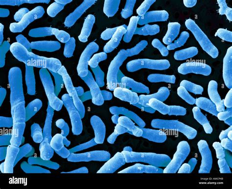 Sem Bifidobacterium Pullorum Microscopic Stock Photo 4970058 Alamy