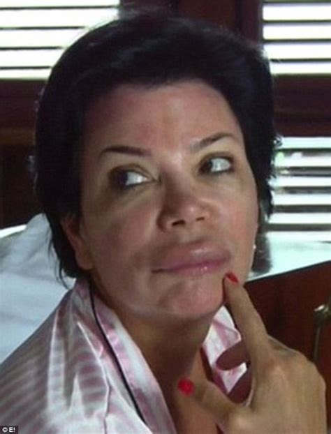 kris jenner cancels tv appearance after lip swells up from suspected insect bite daily mail online