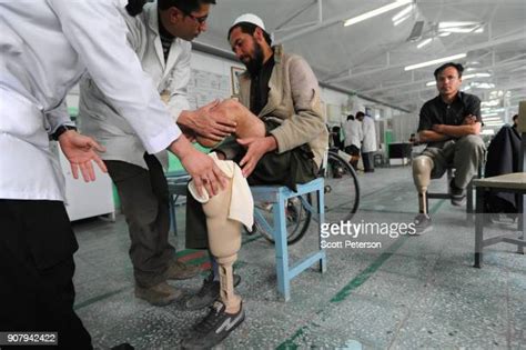 Afghanistan Orthopedic Center Helps War Victims Despite Reducing