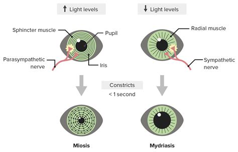 Miosis Is Of The Pupil