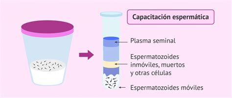 Cómo es el proceso de la fecundación in vitro paso a paso