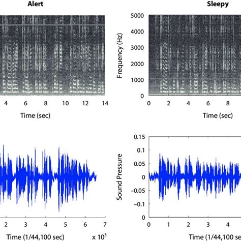 Typical Spectrograms And Waveforms Of The Same Utterance For An Alert