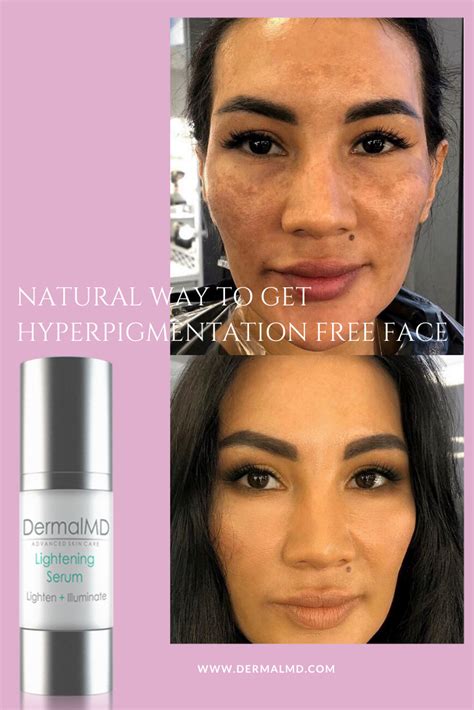 Struggling to get your skin tones right in lightroom? Make Skin Lighter | Skin lightening serum, Lightening ...