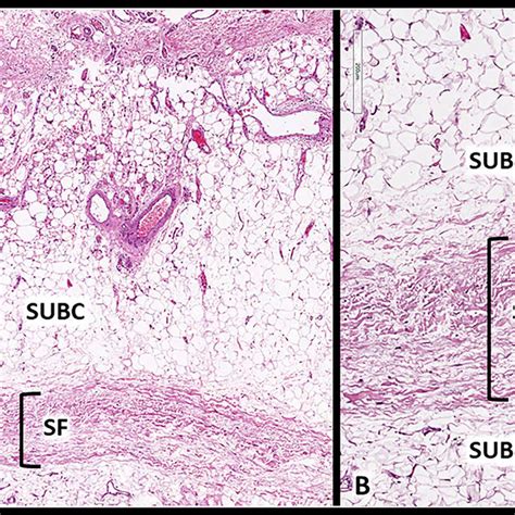 Histology Of The Superficial Fascia Superficial Fascia Sf Is A Thin