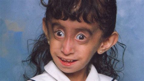 They Called Her ‘the World’s Ugliest Girl’ Here’s What Happened To Her Now Youtube