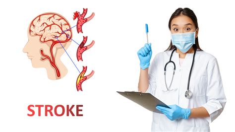 Hermina Hospitals Sign Of Stroke That You Need To Know