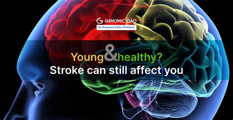 Young And Healthy Stroke Can Still Affect You