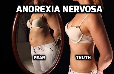 Symptoms Effects And Treatment Of Anorexia Nervosa