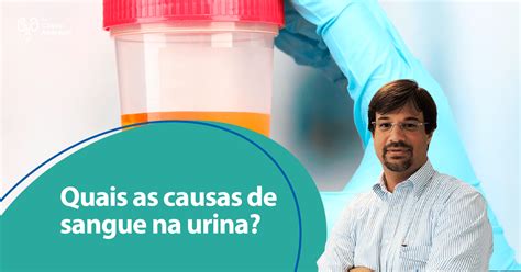 Quais As Causas De Sangue Na Urina Dr C Ssio Andreoni Urologista Crm