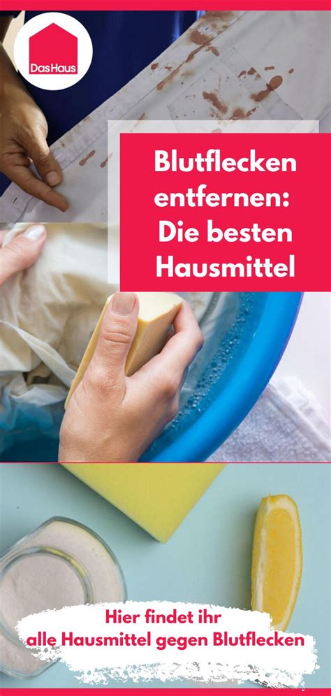 Kaltes wasser und altbewährte hausmittel sind jedoch wirkungsvolle und natürliche alternativen zu aggressiven fleckenmitteln. Blutflecken entfernen mit Hausmitteln: So geht's - DAS ...