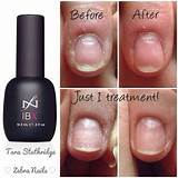 Images of How To Do A Nail Repair