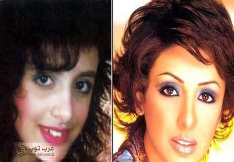 نصائح قبل القيام بعمليات التجميل عمليات التجميل يهتم أغلب الناس بتحقيق. الرأي نيوز ثقافة و فنون : صور صادمة لـ فنانات عربيات قبل ...