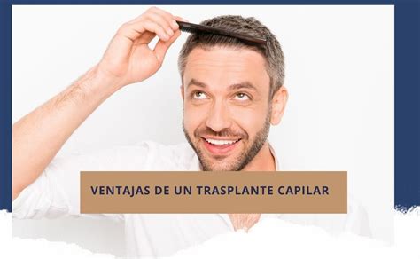 Ventajas De Un Trasplante Capilarreina Hair Transplant