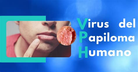 Virus Del Papiloma Humano Servi Med Laboratorios Clínicos