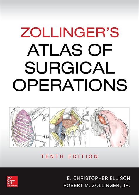 Zollingers Atlas Of Surgical Operations 10e Accesssurgery Mcgraw