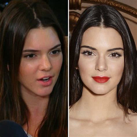 12 Best Kendall Jenner Without Makeup Styles At Life