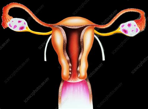 Female Reproductive Organs Stock Image P6160069 Science Photo