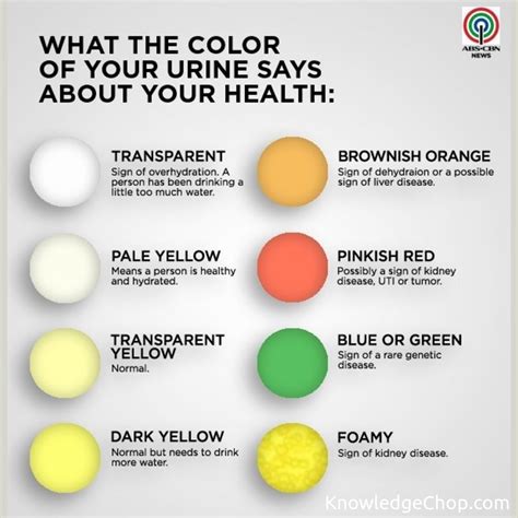 What Your Urine Color Indicates This Hasnt Been Posted In Awhile