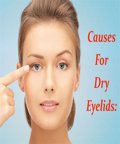 5 Ways To Relieve Dry Skin On Eyelids Naturally In No Time In 2021