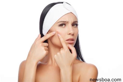 Home Remedies For Acne And Senstive Skinknow The Remedies