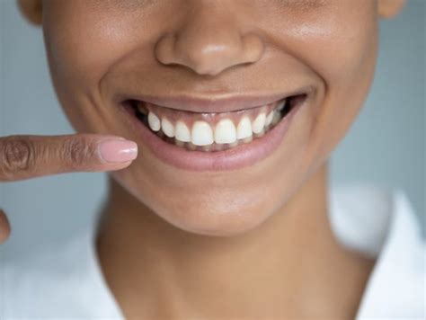 Why Healthy Gums Matter