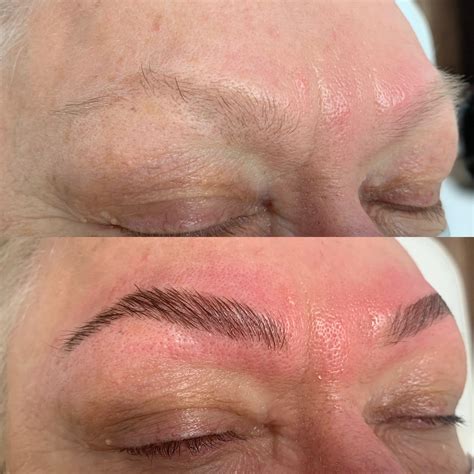 Before And After Brow Lamination Dérmica Medesthetics