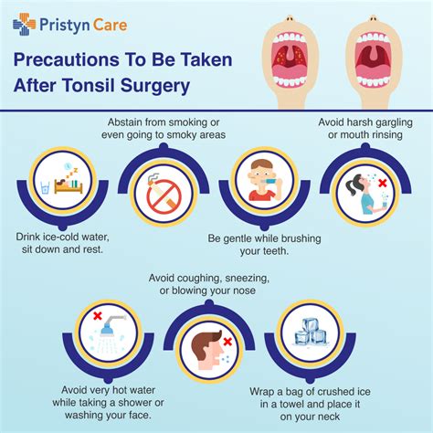 Tonsillectomy Procedure Step By Step