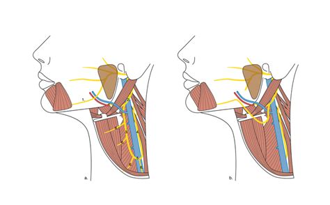 A Normal Anatomy Of The Marginal Mandibular Nerve Mmn And Ansa