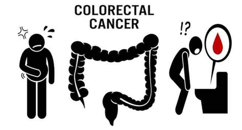 Colon Cancer Screening Cartoon