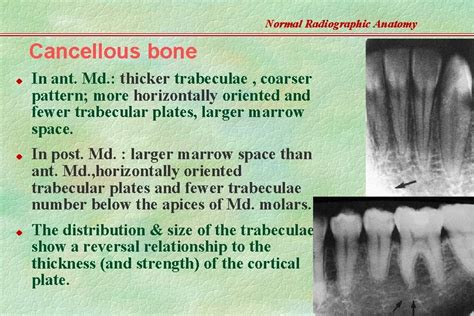 Normal Radiographic Anatomy Based On Intraoral Films Teeth