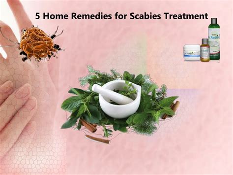 ppt 5 home remedies for scabies treatment powerpoint presentation free download id 7136252