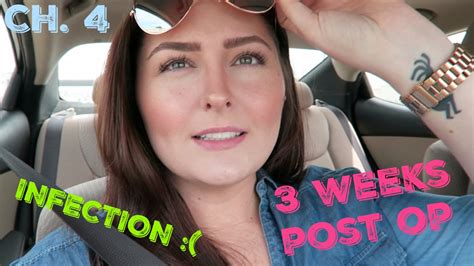 Breast Reduction Vlog Series Ch 4 Three Weeks Post Op And Infected