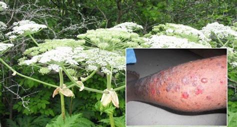 Plant That Blinds Found In Michigan Learn About The Hogweed Plants