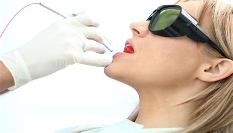 Treating Herpes With Laser Therapy