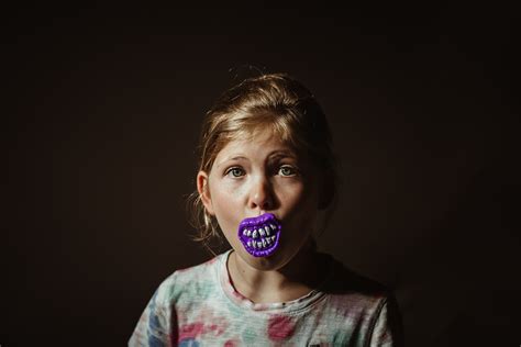 Bad Teeth By Monica Carlson