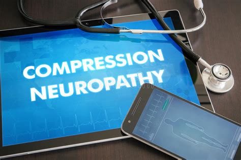 Compression Neuropathy Neurological Disorder Diagnosis Medical Stock