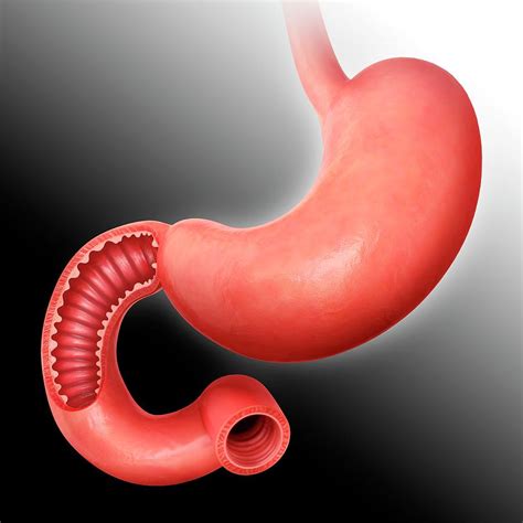 Small Intestine And Stomach Photograph By Pixologicstudio Fine Art