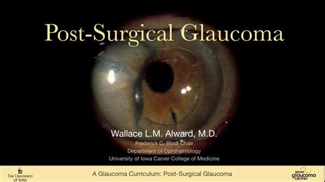 Post Surgical Glaucoma Aphakic Epithelial Downgrowth Post Pk Post