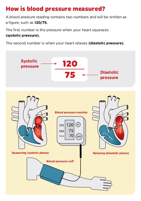 High Blood Pressure Hypertension Medical Notes