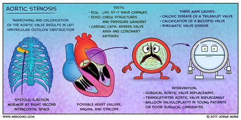 Aortic Stenosis By Medcomic Redbubble