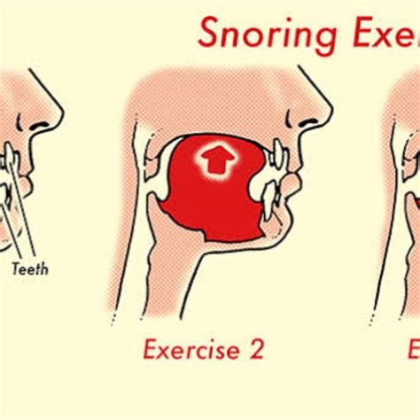 Tongue Exercise 2 Tongue Push Up By Vincent H Exercise How To