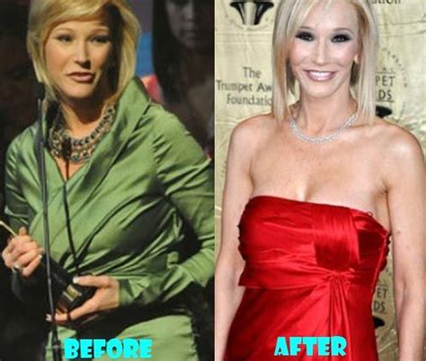 Paula White Plastic Surgery Before And After Photo