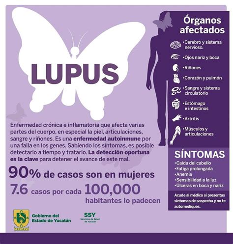 ¿qué Es El Lupus Health Info Health And Nutrition Health And