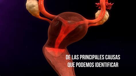 Sangrado Uterino Anormal YouTube