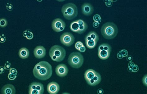 Methodical Madness Cryptococcus Neoformans