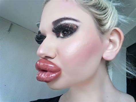 Самые большие в мире губы как выглядит девушка после 20 операций ФОТО ВИДЕО ИНФОРМЕР