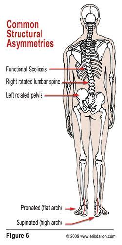 Many of my clients experience lower back and hip pain simultaneously. Pin on Tips