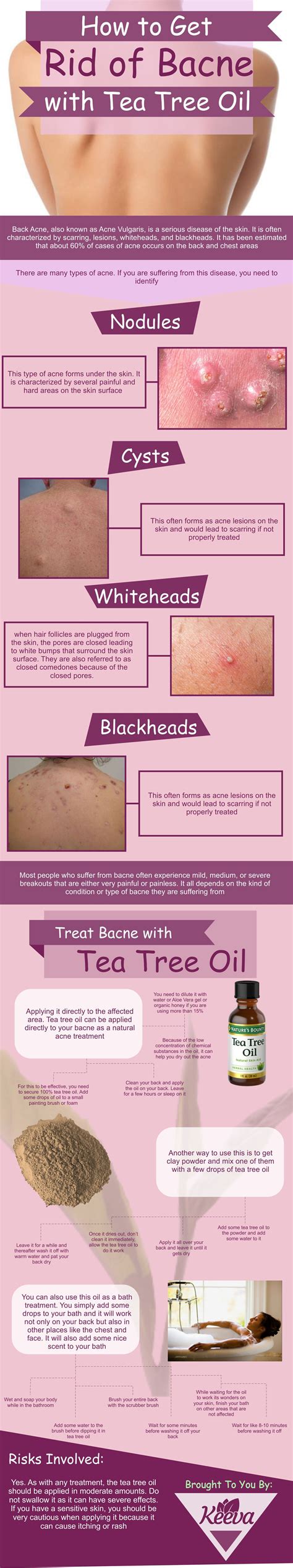 How To Get Rid Of Bacne Back Acne With Tea Tree Oil Serum Tree Oil