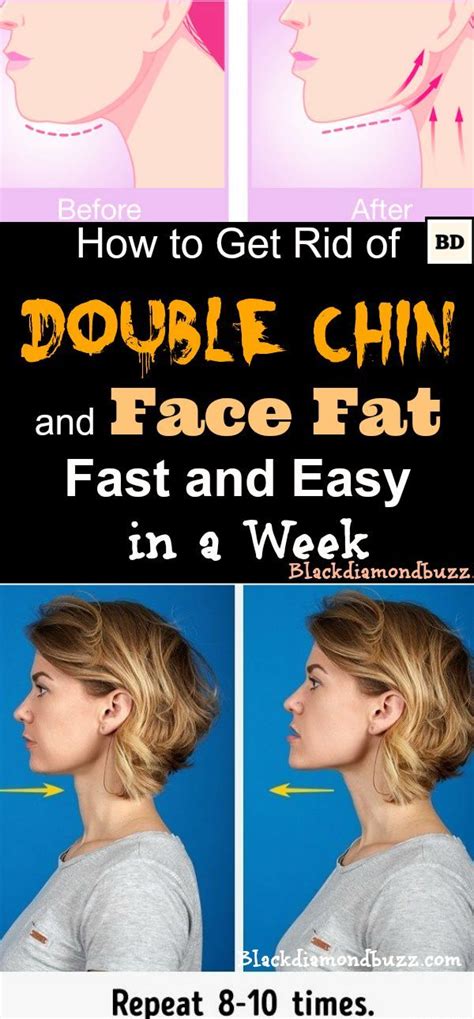 15 Exercises To Get Rid Of A Double Chin Without Surgery Ideas